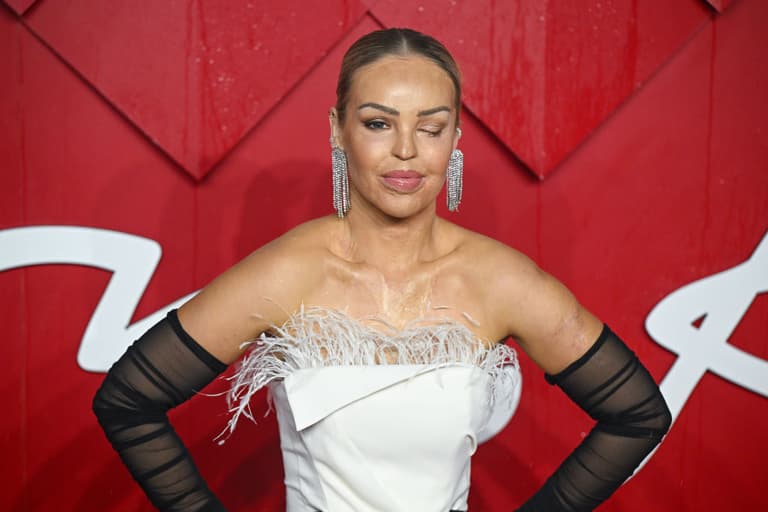 ‘I’ve got a defect and an infection’ – Katie Piper updates fans after surgery to ‘avoid losing her eye’ ‘I’ve got a defect and an infection’ – Katie Piper updates fans after surgery to ‘avoid losing her eye’
