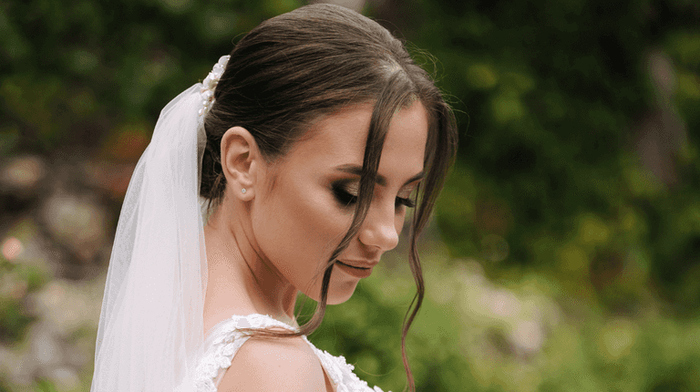 Brides warned against getting Botox ahead of their wedding day – here’s why Brides warned against getting Botox ahead of their wedding day – here’s why