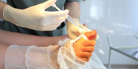 New Cosmetic Surgery Tackles Problem of Fat Toes, “Toe-besity”
