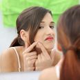 Operation No-Blemish: How To Zap That Spot And Pop The Pimple