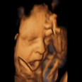 The Most Amazing Piece Of Research: 4D Scan Shows Babies Yawning In The Womb