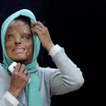 Indian Acid Attack Victim Claims Top Prize in ‘Who Wants to be a Millionaire’