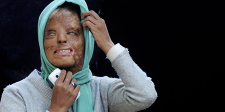 Indian Acid Attack Victim Claims Top Prize in ‘Who Wants to be a Millionaire’