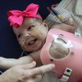 Baby Audrina Goes Home: Miracle Defies Odds As She Is Born With Her Heart Beating Outside Her Body