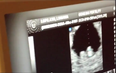 Singer And Model Reveal To The World They Are Expecting Their First Bundle Of Joy In A Sweet YouTube Video