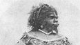 The “Ugliest Woman In The World” Is Buried After 150 Years And An Amazing Tale Of Courage