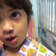 Operation Smile: Little Girl Sees Herself For The First Time After Undergoing Cleft Lip Surgery