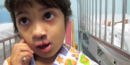 Operation Smile: Little Girl Sees Herself For The First Time After Undergoing Cleft Lip Surgery