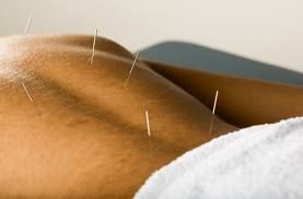 “I’m a Therapist, Not a Prostitute!” – Irish Acupuncturist Hits Back After Series of Lewd Responses to Advert