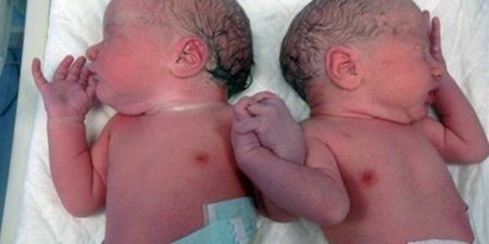 Don’t Let Go: Incredible Picture Of Twins Holding Hands Minutes After Birth