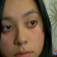 Family Appeal for Financial Support to Help Chilean Woman Who Cries Tears of Blood