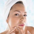 Putting Your Best Face Forward – Top Tips For Acne And Problematic Skin