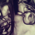 Actress Reveals She Is Expecting Twins By Sharing Sonogram