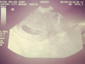 Forget A Pie, It’s A Bun In The Oven For This Star Couple