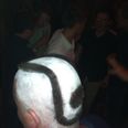 Head The Ball: Interesting Hurling Inspiring Haircut Spotted