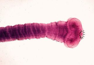 Desperate To Lose Weight: Woman Swallows Tapeworm In A Bid To Get Skinny