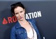Ouch That’s Got to Hurt! Actress Shares Photo of Painful-Looking Sunburn