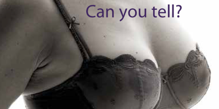 Open Evening Set to Highlight Major Advances in Breast Reconstruction Surgery for BRA Day