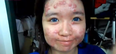 ‘Before And After’ – Incredible Step By Step Video On How To Camouflage Acne
