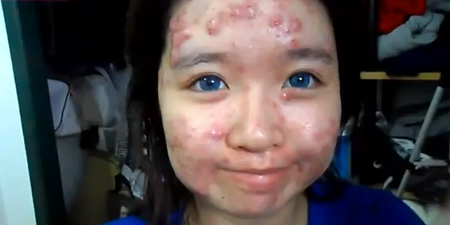 ‘Before And After’ – Incredible Step By Step Video On How To Camouflage Acne