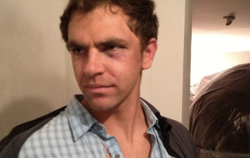 Deaf Man Tasered And Beat After Police Mistake Sign Language For Gang Gestures