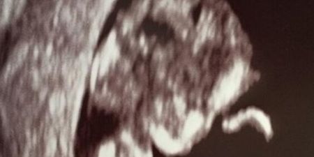 Model Reveals Pregnancy With Sonogram Snap on Twitter