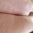 The Human Etch-A-Sketch: A “Skin Writer” Opens Up About Her Skin Condition