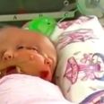 ‘Miracle’ Conjoined Twins Hope and Faith Have Passed Away, 19 Days Old