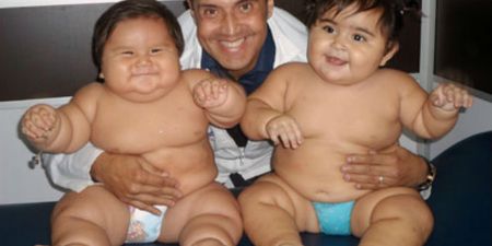 Charity Step in to Deal With Second Obese Colombian Baby