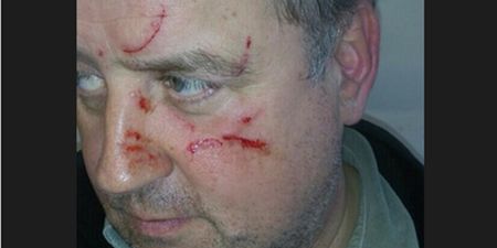 Fine Gael Councillor Allegedly Assaulted While Canvassing In Cork