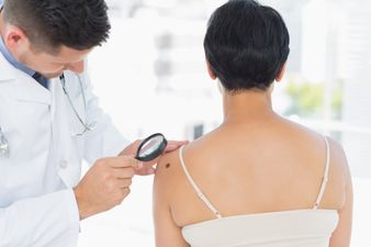 New Skin Cancer Drug Described As ‘Miraculous’ After Remarkable Results