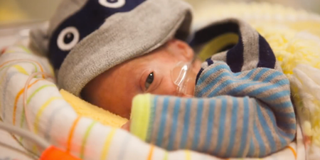 WATCH: 80 Days in ICU – Incredible Time-Lapse Video of a Tiny Premature Baby