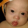Campaign Raises Thousands For Baby With Down Syndrome Who Was Abandoned By His Parents