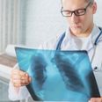 Survey Reveals That One In Every Two People Nationwide Is Affected By Lung Disease