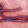 First Case of Ebola Confirmed In The US
