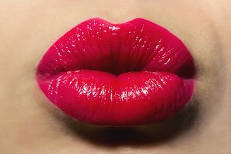 Pucker Up! Will You Give A Kiss For Crumlin This Week? #Kiss4Crumlin