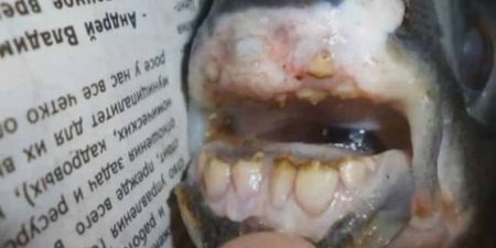 Something’s Biting: Fisherman Pulls A Catch With Human Teeth