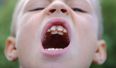 Schoolboy Proudly Shows Off His Second Set Of Teeth
