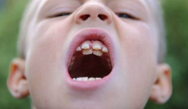 Schoolboy Proudly Shows Off His Second Set Of Teeth