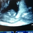 WATCH: This Baby Can Clap Along To Music In The Womb…