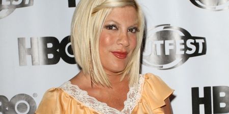 Tori Spelling Undergoes Skin Graft After Being Rushed To Hospital With Severe Burns