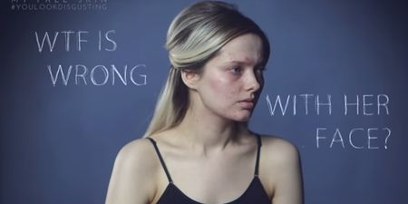 YouTube Vlogger Calls Out Acne Shamers With Powerful Video