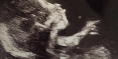 TOWIE Favorite Kirk Norcross Announces Exciting Baby News