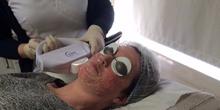 I Tried IPL Skin Rejuvenation Treatment and This Is What Happened