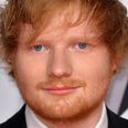 This guy is the spit of Ed Sheeran but says it has one major downside