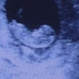 PIC: This Eery Ultrasound Image Is The Latest Picture To Divide The Internet