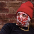 Why Rubberbandits’ Blindboy Deserves A Round Of Applause