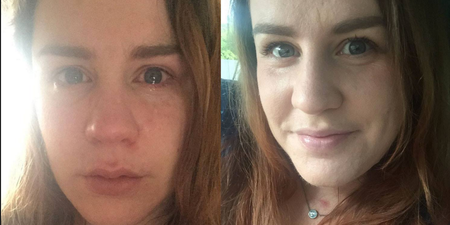 An Australian Woman Has Responded To A Controversial Article About Faking Mental Illness