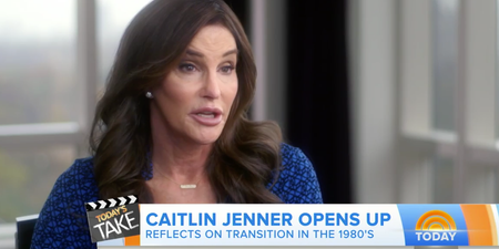 Caitlyn Jenner Had Her 36B Breasts Removed When She Met Kris In The 80’s