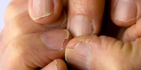 This One Kitchen Staple Is The Trick To Growing Stronger, Longer Nails